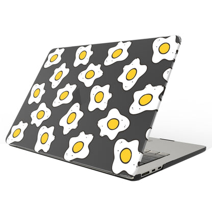 UV Printed Pattern Laptop Frosted Protective Case